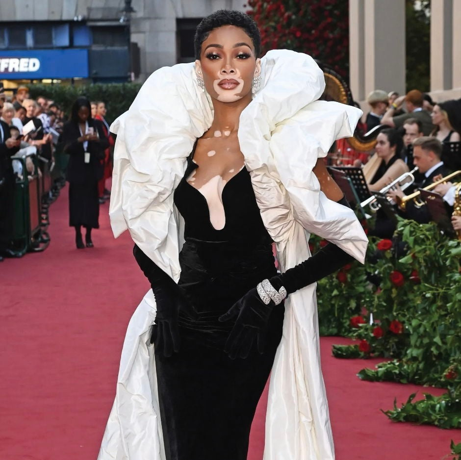 Winnie Harlow | Vogue World-Cornelia James